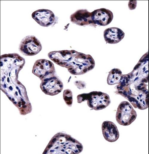 SOCS6 Antibody immunohistochemistry of formalin-fixed and paraffin-embedded human placenta tissue followed by peroxidase-conjugated secondary antibody and DAB staining.