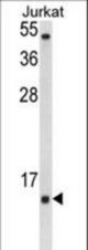 Western blot of SOD1 Antibody in Jurkat cell line lysates (35 ug/lane). SOD1 (arrow) was detected using the purified antibody.