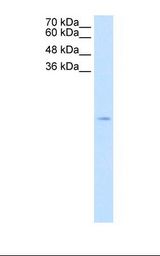 Jurkat cell lysate. Antibody concentration: 2.5 ug/ml. Gel concentration: 15%.