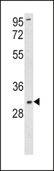 Western blot of SOD3 Antibody in K562 cell line lysates (35 ug/lane). SOD3 (arrow) was detected using the purified antibody.