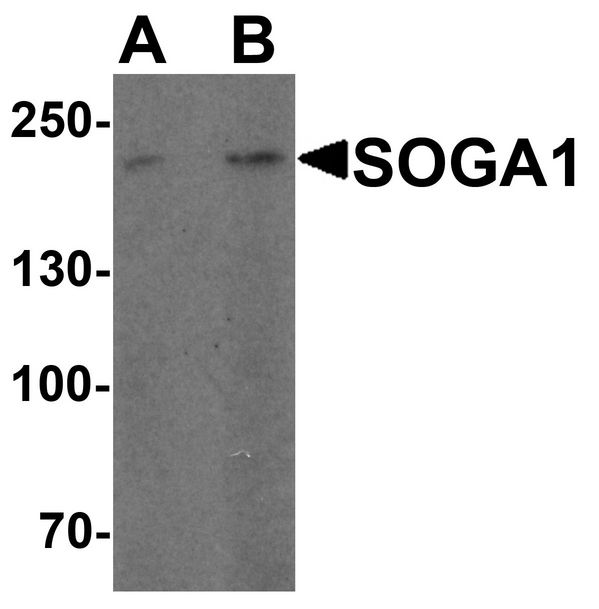 Western blot analysis of SOGA1 in HeLa cell lysate with SOGA1 antibody at (A) 1 and (B) 2 ug/ml.