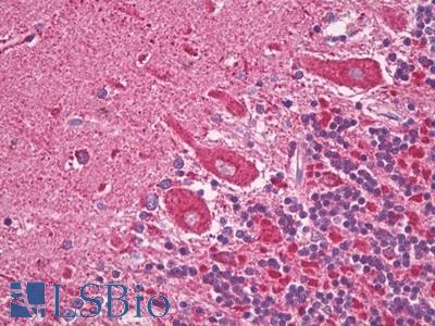 Anti-SOGA1 antibody IHC of human brain, cerebellum, Purkinje. Immunohistochemistry of formalin-fixed, paraffin-embedded tissue after heat-induced antigen retrieval. Antibody LS-B7833 dilution 5 ug/ml.