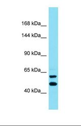 Western blot of OVCAR-3. KIAA1045 antibody dilution 1.0 ug/ml.