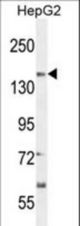 CT117 Antibody western blot of HepG2 cell line lysates (35 ug/lane). The CT117 antibody detected the CT117 protein (arrow).