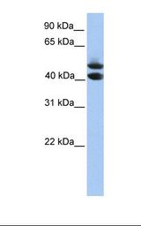 HepG2 cell lysate. Antibody concentration: 1.0 ug/ml. Gel concentration: 12%.