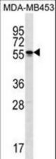 SOHLH2 Antibody western blot of MDA-MB453 cell line lysates (35 ug/lane). The SOHLH2 antibody detected the SOHLH2 protein (arrow).