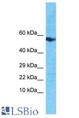 SOHLH2 antibody Western Blot of MDA-MB-435s. Antibody dilution: 1 ug/ml.