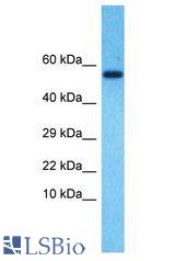 SOHLH2 antibody Western Blot of Fetal Lung. Antibody dilution: 1 ug/ml.