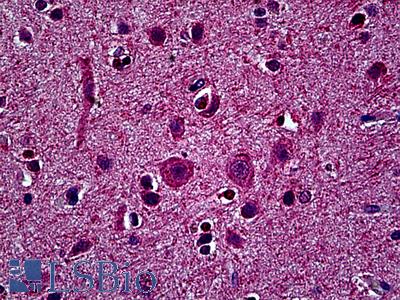 Anti-SESTD1 antibody IHC of human brain, cortex. Immunohistochemistry of formalin-fixed, paraffin-embedded tissue after heat-induced antigen retrieval. Antibody LS-B5489 concentration 5 ug/ml.