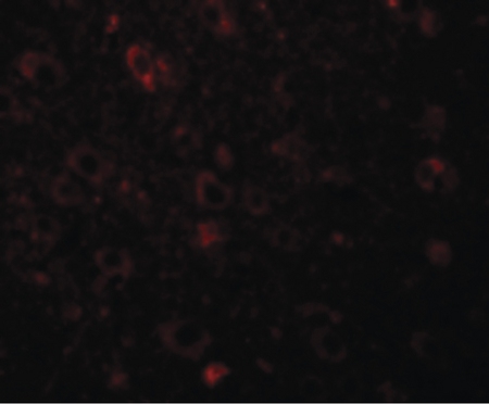 Immunofluorescence of SESTD1 in Human Brain cells with SESTD1 antibody at 20 ug/ml.