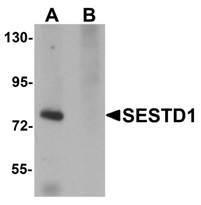 Western blot analysis of SESTD1 in rat brain tissue lysate with SESTD1 antibody at 1 ug/ml in (A) the absence and (B) the presence of blocking peptide.