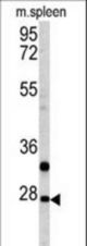 Western blot of PTHLH antibody in mouse spleen tissue lysates (35 ug/lane). PTHLH (arrow) was detected using the purified antibody.