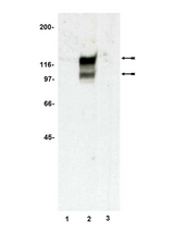 WB: Preadipocytes (lane 1) and adipocytes (lanes 2 & 3) from 3T3-L1 cell lysates were probed with anti-CAP (lane 1 & 2) or anti-CAP preincubated with peptide (lane 3).