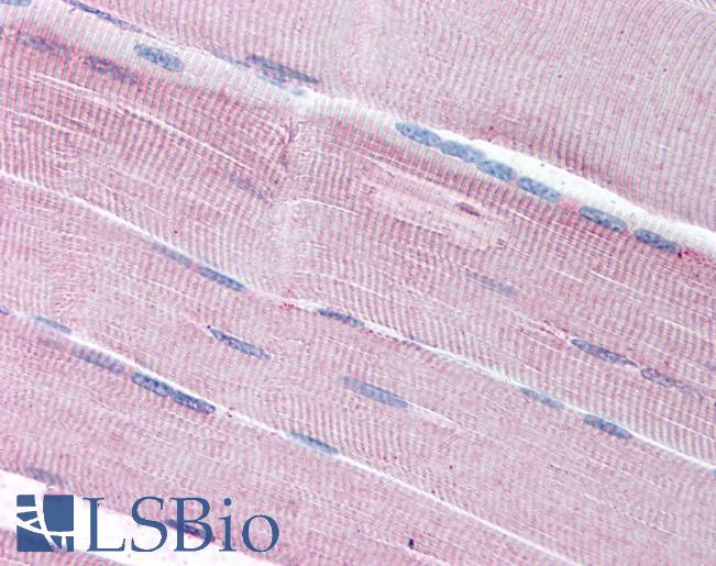 Anti-SORBS1 antibody IHC of human skeletal muscle. Immunohistochemistry of formalin-fixed, paraffin-embedded tissue after heat-induced antigen retrieval. Antibody LS-B1763 concentration 5 ug/ml.