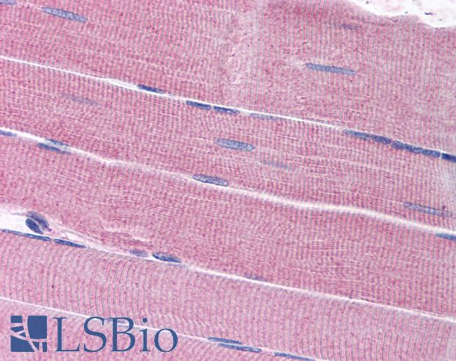 Anti-SORBS1 antibody IHC of human skeletal muscle. Immunohistochemistry of formalin-fixed, paraffin-embedded tissue after heat-induced antigen retrieval. Antibody LS-B1762 concentration 5 ug/ml.