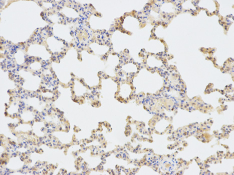Immunohistochemistry of paraffin-embedded rat lung using SORD antibody at dilution of 1:200 (200x lens).