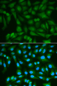 Immunofluorescence analysis of MCF7 cell using SORD antibody. Blue: DAPI for nuclear staining.