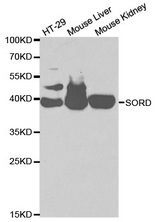 Western blot analysis of extracts of various cell lines, using SORD antibody.