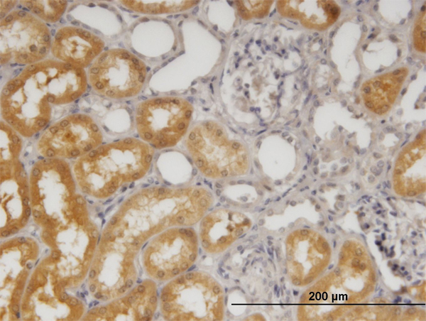 Immunoperoxidase of monoclonal antibody to SORD on formalin-fixed paraffin-embedded human kidney. [antibody concentration 1.2 ug/ml]