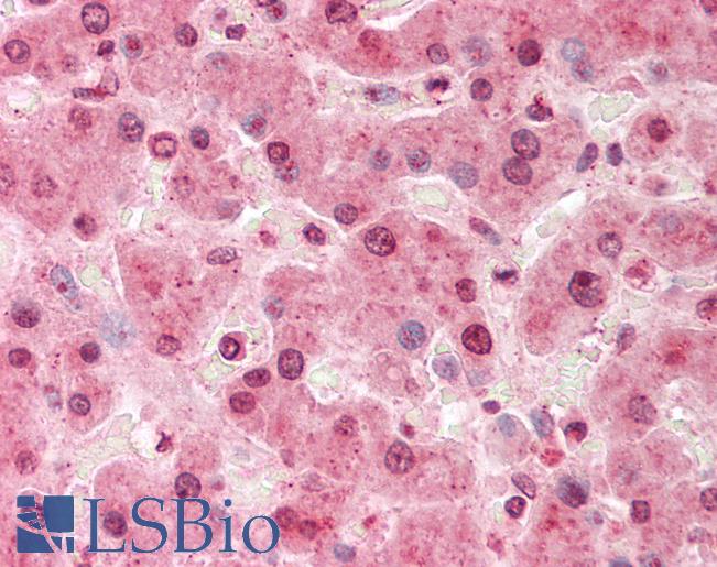 Human Liver: Formalin-Fixed, Paraffin-Embedded (FFPE)