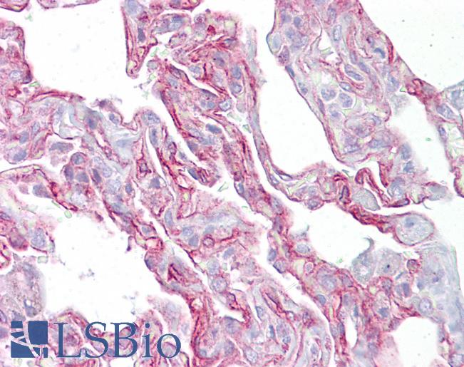 Anti-PTHLH / PTHRP antibody IHC of human lung. Immunohistochemistry of formalin-fixed, paraffin-embedded tissue after heat-induced antigen retrieval. Antibody LS-B6787 concentration 5 ug/ml.