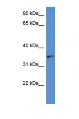 SORD antibody western blot of HeLa cell lysate. Antibody concentration 1 ug/ml.