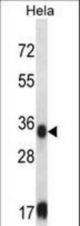 SORD Antibody western blot of HeLa cell line lysates (35 ug/lane). The SORD antibody detected the SORD protein (arrow).