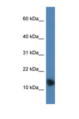 PTHLH / PTHRP antibody LS-B6787 Western blot of Mouse Brain lysate. Antibody concentration 1 ug/ml.