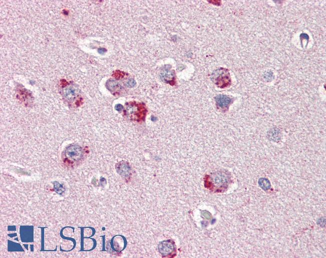 Anti-SORL1 antibody IHC of human brain, cortex. Immunohistochemistry of formalin-fixed, paraffin-embedded tissue after heat-induced antigen retrieval. Antibody LS-B3464 dilution 1:200.