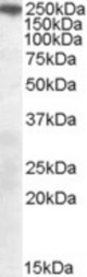 SORL1 antibody (0.3 ug/ml) staining of Mouse Brain lysate (35 ug protein/ml in RIPA buffer). Primary incubation was 1 hour. Detected by chemiluminescence.