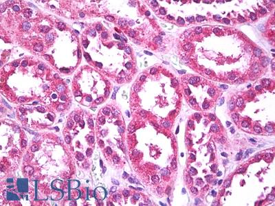 Anti-PTHR / PTHR1 antibody IHC of human kidney. Immunohistochemistry of formalin-fixed, paraffin-embedded tissue after heat-induced antigen retrieval. Antibody LS-B7767 dilution 20 ug/ml.