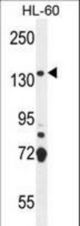 SOS2 Antibody western blot of HL-60 cell line lysates (35 ug/lane). The SOS2 antibody detected the SOS2 protein (arrow).