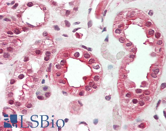 Human Kidney: Formalin-Fixed, Paraffin-Embedded (FFPE)