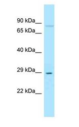 SOST / Sclerostin antibody Western Blot of MCF7 whole cell lysate.