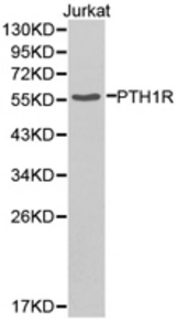Western blot of extracts of Jurkat cell lines, using PTH1R antibody.