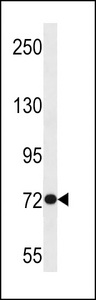 ANKRD56 Antibody western blot of Jurkat cell line lysates (35 ug/lane). The ANKRD56 antibody detected the ANKRD56 protein (arrow).