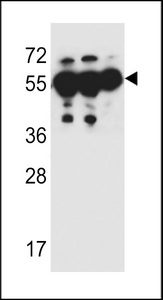 ANKRD57 Antibody western blot of MDA-MB231,HepG2,A549 cell line lysates (35 ug/lane). The ANKRD57 antibody detected the ANKRD57 protein (arrow).