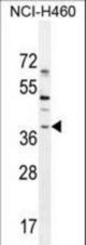 SOX1 Antibody western blot of NCI-H460 cell line lysates (35 ug/lane). The SOX1 antibody detected the SOX1 protein (arrow).