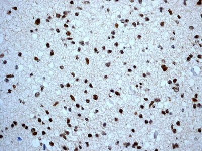 IHC of paraffin-embedded human fetal brain tissue using anti-SOX1 antibody.