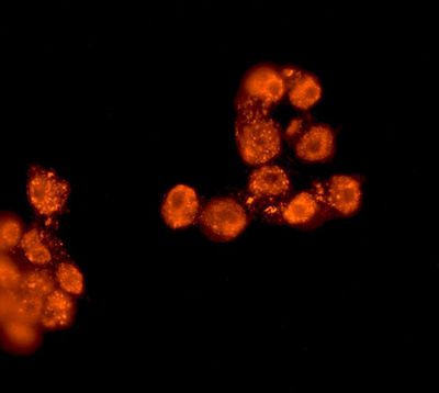 Immunofluorescent staining of NCCIT cells using anti-SOX1 antibody.