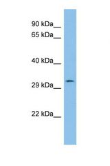 Western blot of Human ACHN. PTH1R antibody dilution 1.0 ug/ml.