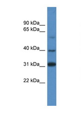 SOX1 antibody LS-C134985 Western blot of 293T Cell lysate. Antibody concentration 1 ug/ml.