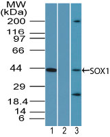 Western blot of SOX1 in human brain lysate in the 1) absence and 2) presence of immunizing peptide and 3) mouse brain lysate using LS-C148599 at 0.5 ug/ml, 0.5 ug/ml and2 ug/ml respectively. Goat anti-rabbit Ig HRP secondary antibody, and PicoTect ECL substrate solution, were used for this test.
