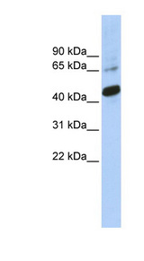 SOX1 antibody LS-C110312 Western blot of Jurkat lysate.