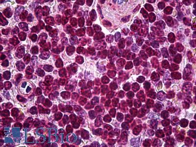 Anti-SOX10 antibody IHC of human spleen. Immunohistochemistry of formalin-fixed, paraffin-embedded tissue after heat-induced antigen retrieval. Antibody LS-B5939 concentration 5 ug/ml.