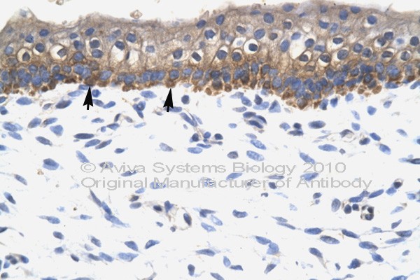 SOX10 antibody LS-C134958 IHC of formalin-fixed, paraffin-embedded human Skin. Positive label: Epidermal cells indicated with arrows. Antibody concentration 4-8 ug/ml. Magnification 400X.