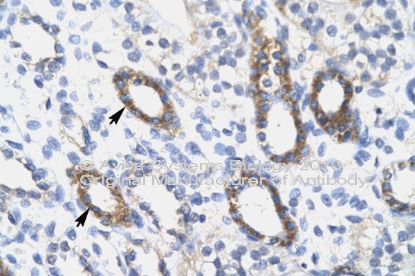 SOX10 antibody LS-C134958 IHC of formalin-fixed, paraffin-embedded human Kidney. Positive label: Epithelial cells of renal tubule indicated with arrows. Antibody concentration 4-8 ug/ml. Magnification 400X.