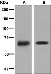 Western blot analysis on (A) fetal brain and (B) Y79 lysates using anti-SOX11 antibody.