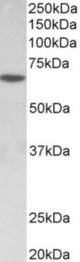 SOX11 antibody (0.5 ug/ml) staining of MOLT4 lysate (35 ug protein in RIPA buffer). Primary incubation was 1 hour. Detected by chemiluminescence.