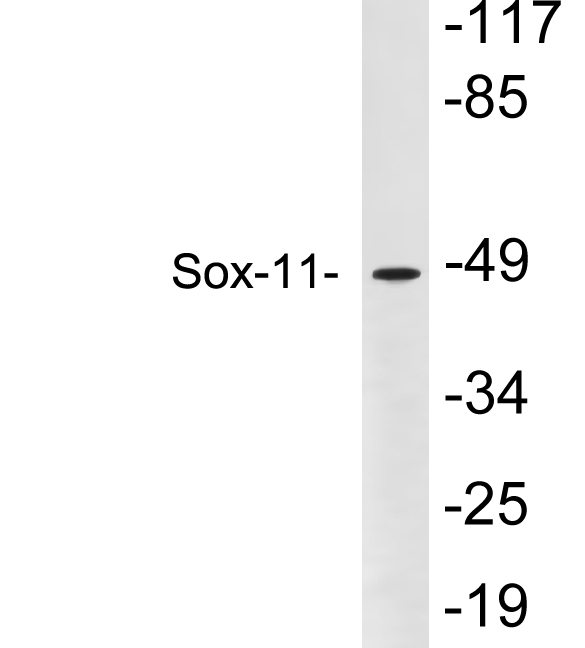 Western blot of extracts from Y79 cells, using Sox-11 antibody.